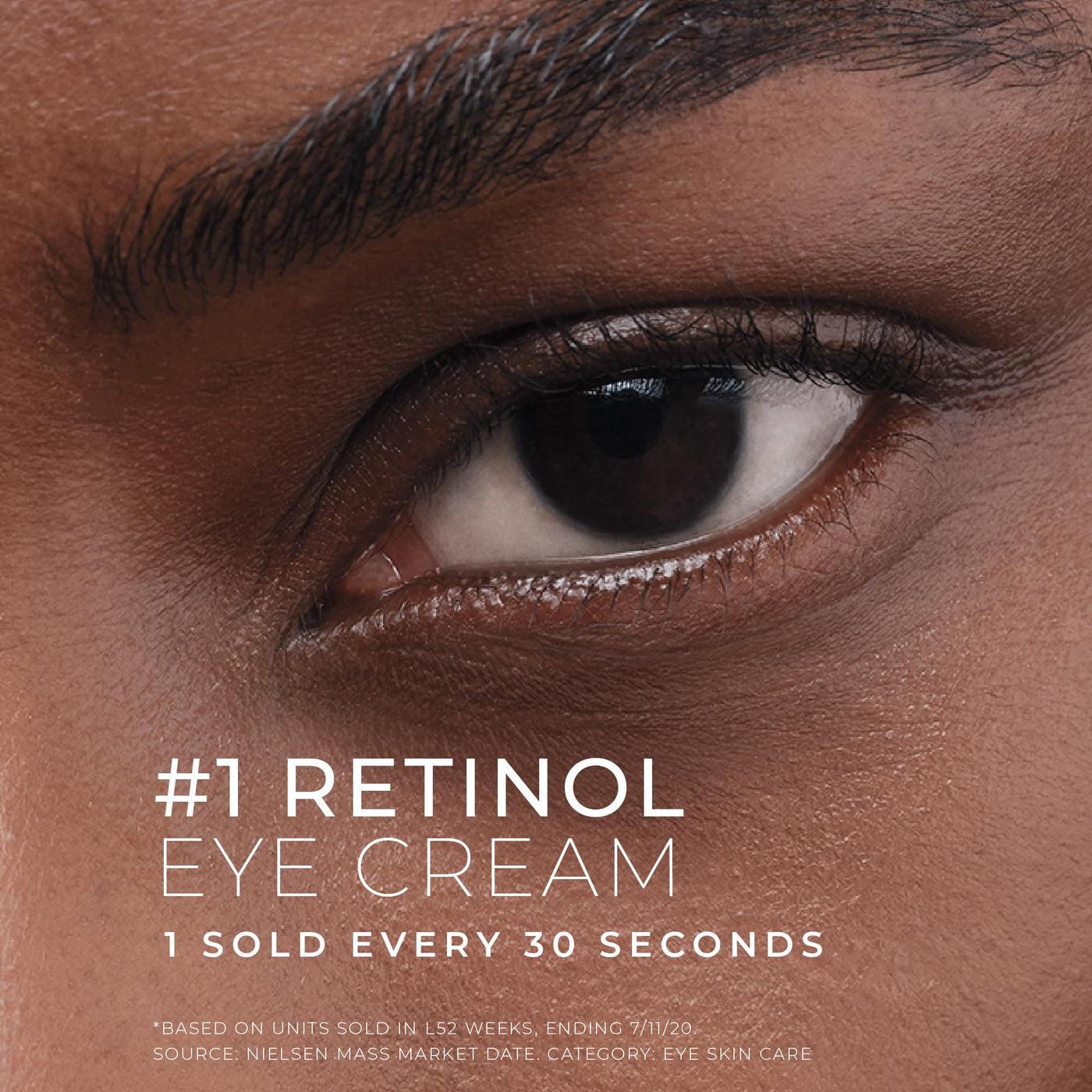 RoC Retinol Eye Cream – Anti-Ageing Treatment for Dark Circles, Puffiness & Wrinkles (0.5 oz)