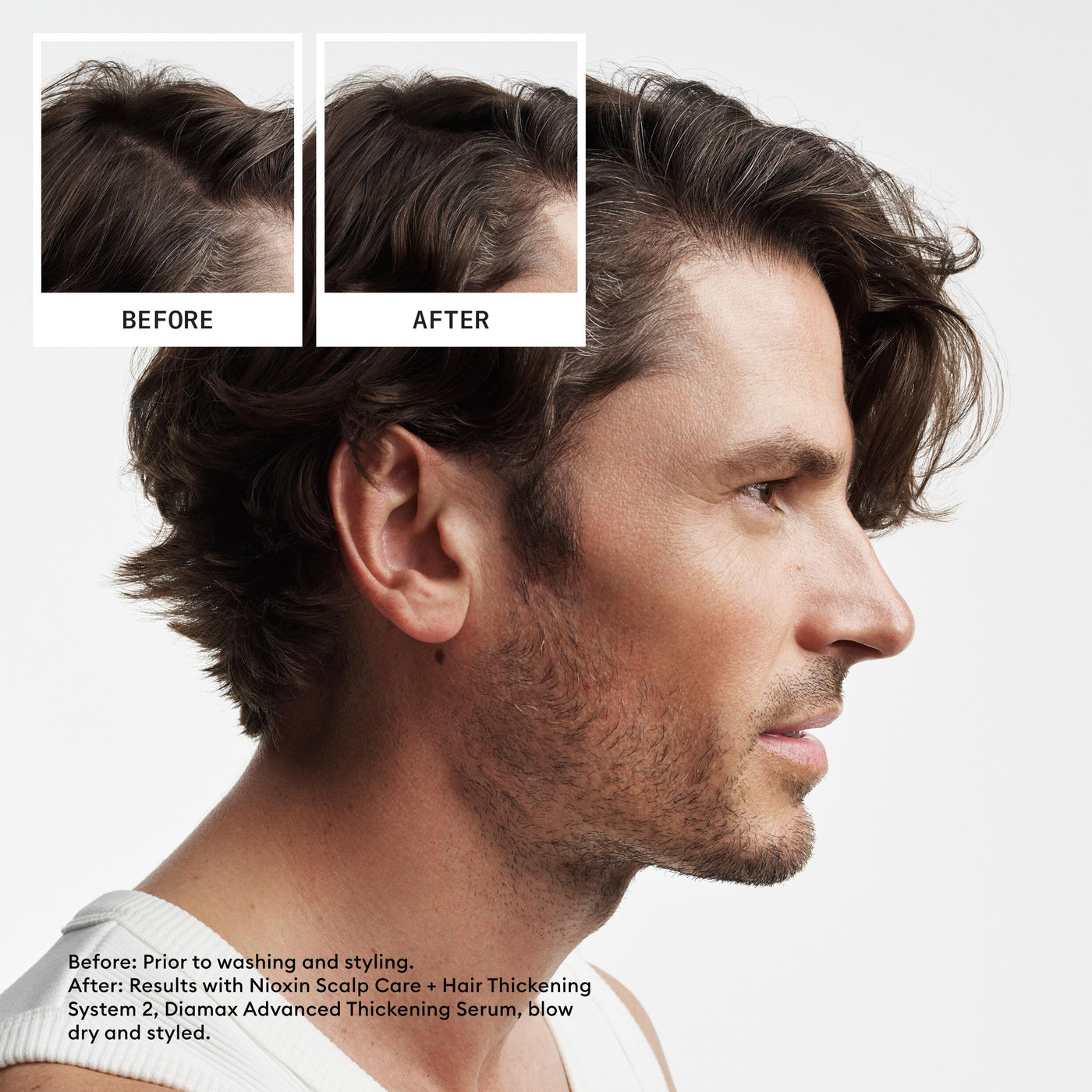 Nioxin System 2 Shampoo – Hair Thickening for Natural Thinning Hair with Niacinamide & Biotin (10.1 oz)